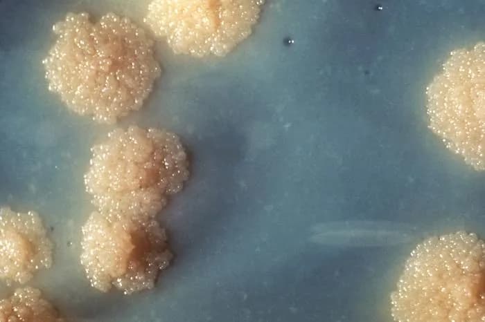 #9 Tuberculosis (TB) — Top 10 Leading Causes of Death Worldwide (WHO 2025)