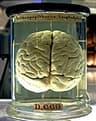 Top 10 Nervous System Regulation Techniques Dominating Wellness in 2026