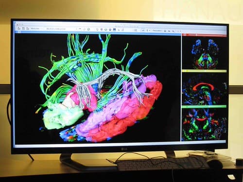 #8 Brain-Training Apps Make You Smarter — Top 10 Most Overhyped Science Headlines