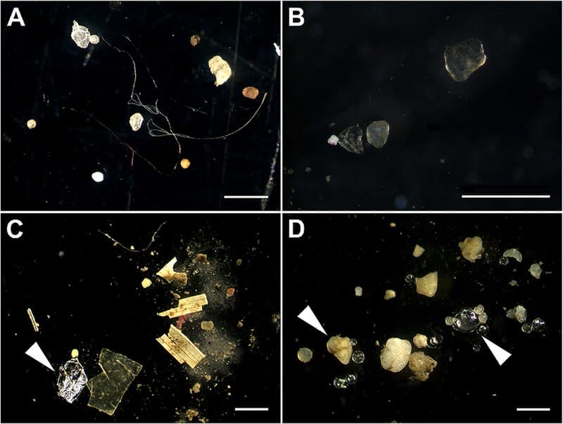 #7 Microplastics Found in Human Brain Tissue — Top 10 Most Significant Scientific Discoveries of 2025