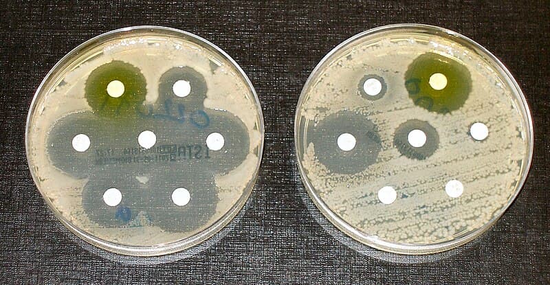 #8 AI Discovers New Antibiotic Class Against Superbugs — Top 10 Most Significant Scientific Discoveries of 2025