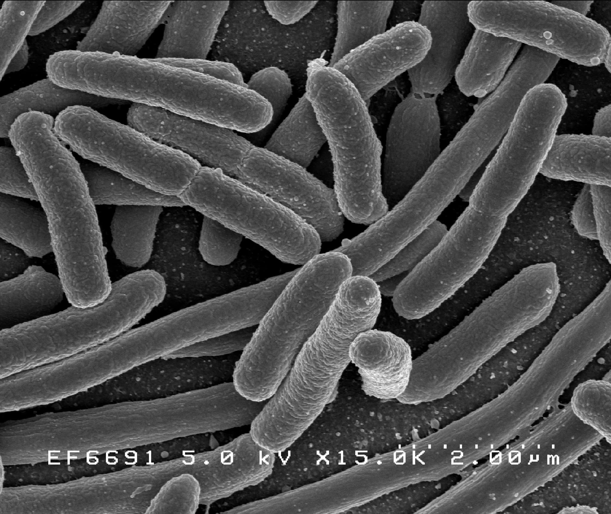 #4 Gut Health Optimization — Top 10 Biggest Wellness Trends of 2025