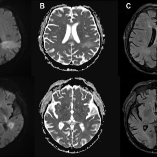 #4 You're likely already infected with a brain-eating virus you've never heard of — Top 10 Ars Technica — Latest — March 21, 2026