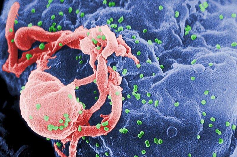 #4 HIV/AIDS (1981-present) — 40+ Million Dead — Top 10 Deadliest Pandemics in Human History — The Diseases That Reshaped Civilization