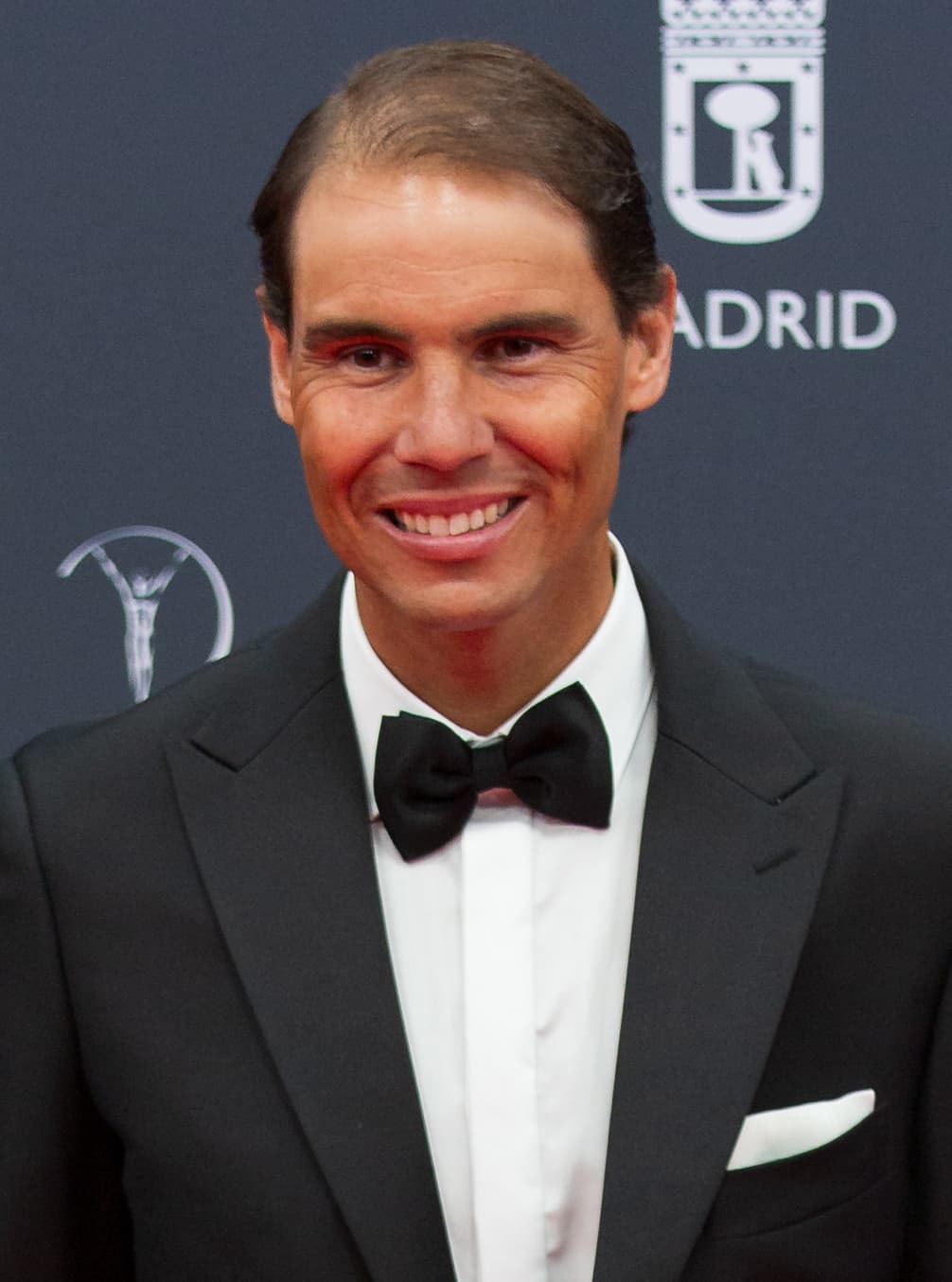 #2 Rafael Nadal — Top 10 Greatest Tennis Players of All Time