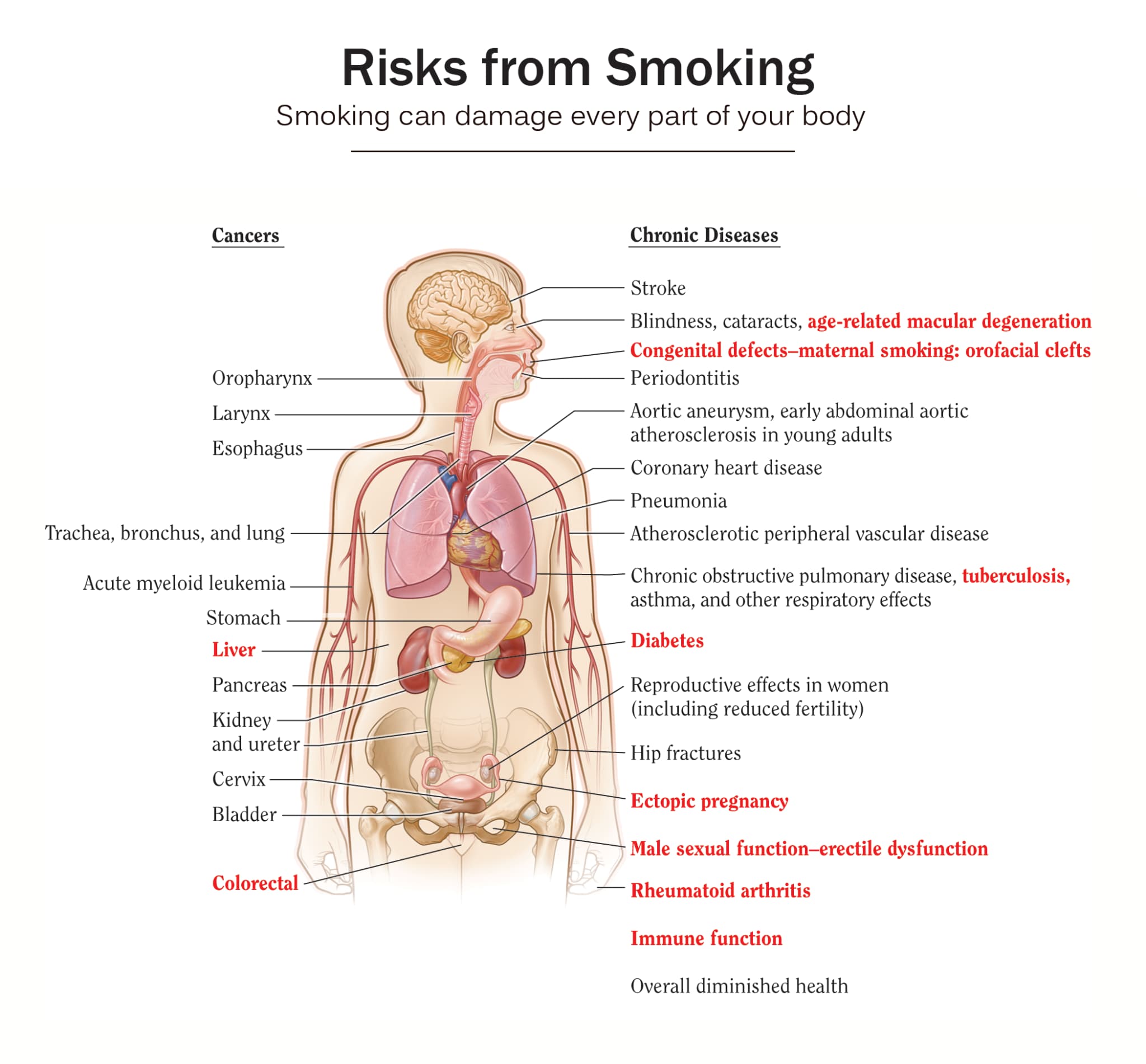 #5 Trachea, Bronchus, and Lung Cancers — Top 10 Leading Causes of Death Worldwide (WHO 2025)