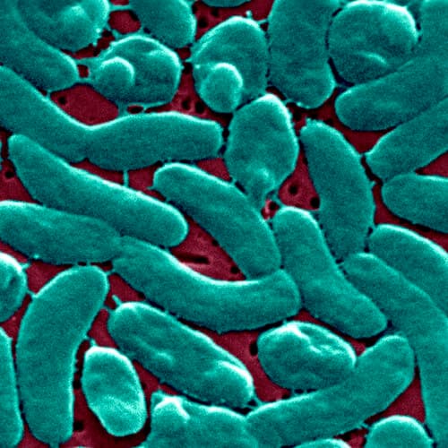#9 Flesh-eating bacteria devour man's arm and leg in just three days — Top 10 Ars Technica — Latest — April 29, 2026
