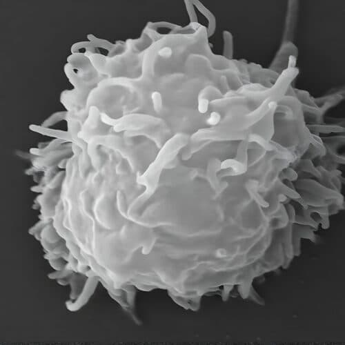 #5 Man dies covered in necrotic lesions after amoebas eat him alive — Top 10 Ars Technica — Latest — May 2, 2026