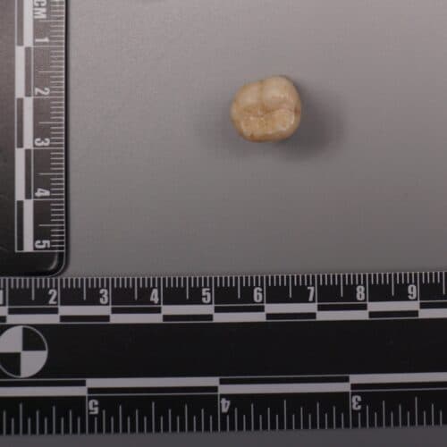 #8 Protein in Homo erectus teeth suggests Denisovans gave us some of their DNA — Top 10 Ars Technica — Latest — May 14, 2026