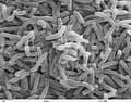 #4 Germ Theory of Disease — Top 10 Greatest Scientific Discoveries of All Time — That Changed the World