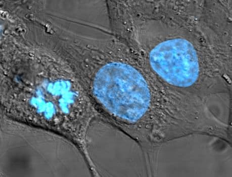 #8 HeLa Cells — The Immortal Cell Line — Top 10 Science Experiments That Sound Like Science Fiction
