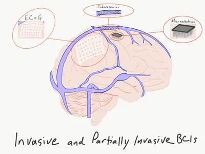 #4 Brain-Computer Interfaces — Top 10 Best Neuroscience Breakthroughs