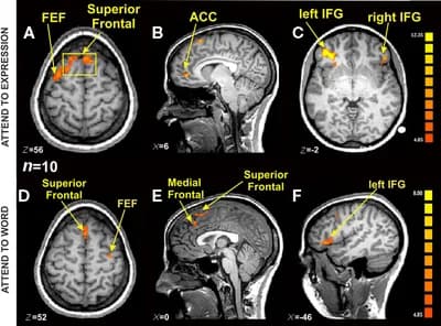#6 Functional MRI (fMRI) — Top 10 Best Neuroscience Breakthroughs