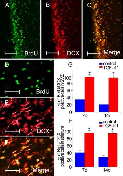#8 Adult Neurogenesis — Top 10 Best Neuroscience Breakthroughs