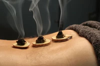 #7 Moxibustion — Top 10 Chinese Traditional Medicine and Wellness Practices Worth Trying
