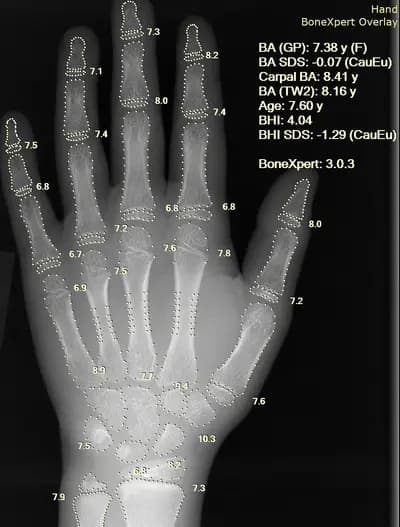 #7 AI-Driven Drug Discovery in the AlphaFold Era — 10 Biotech Breakthroughs Reaching Patients by 2030 — Ranked by Clinical Impact