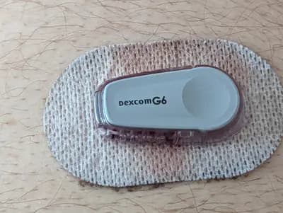 #10 Dexcom Stelo — Best AI Health Wearables & Smart Rings for Developers (2026) — Ranked by API & Data Access