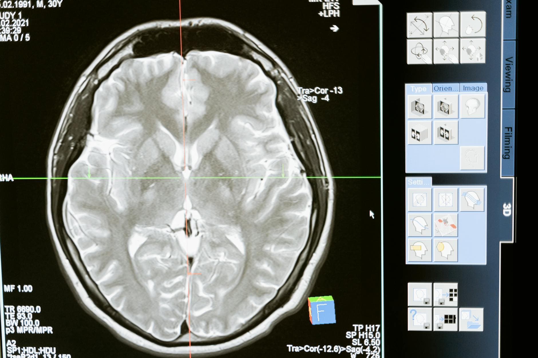 #8 Brain-Boosting Nootropic Stacks — Top 10 Most Overrated Health Supplements